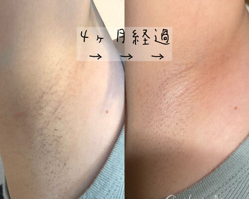 F7CE53FB-9278-47CA-9DCF-6808C6B25009